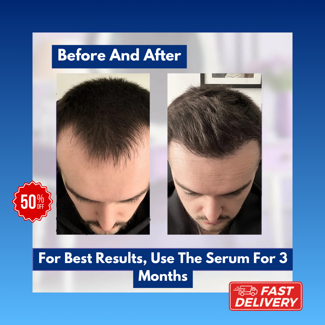 Solara's Hair Growth Transformation Serum