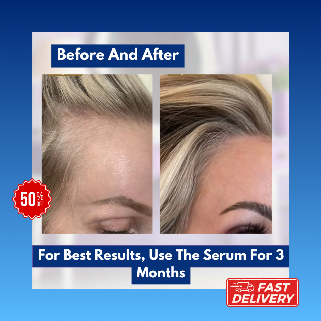 Solara's Hair Growth Transformation Serum