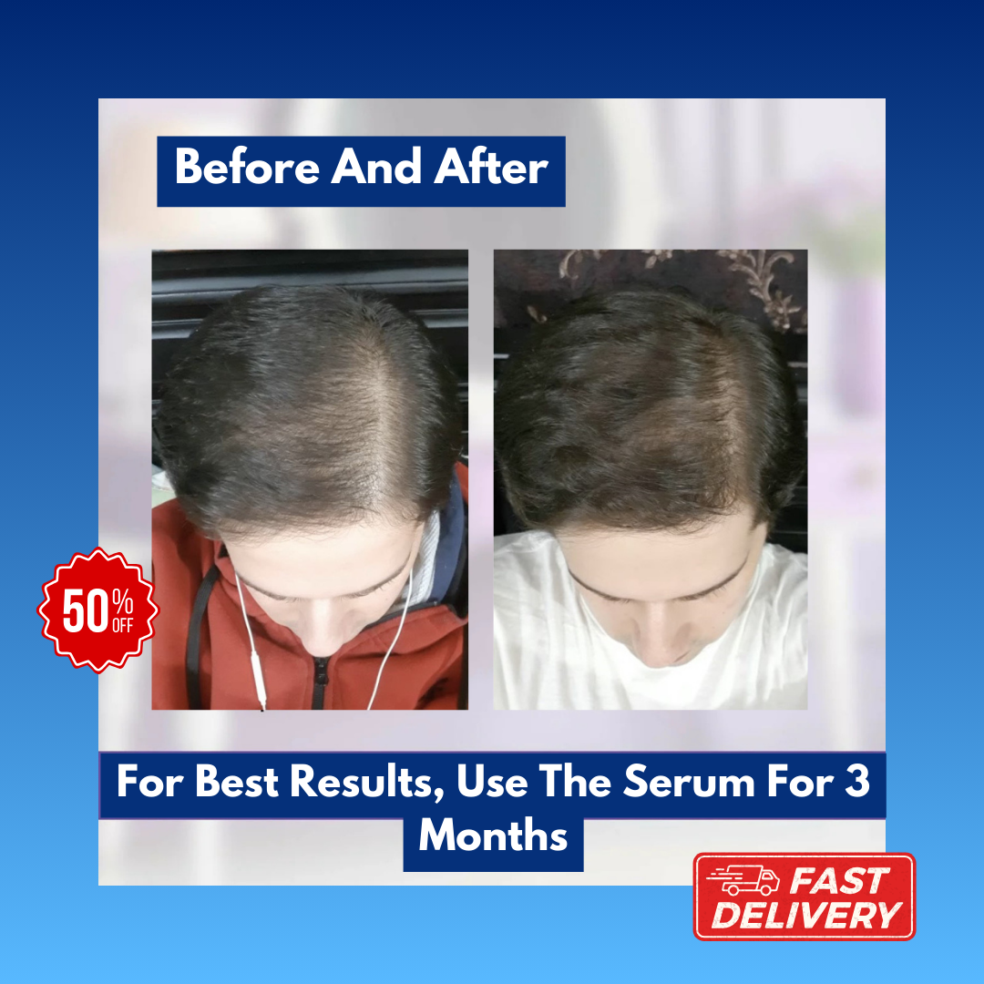 Solara's Hair Growth Transformation Serum