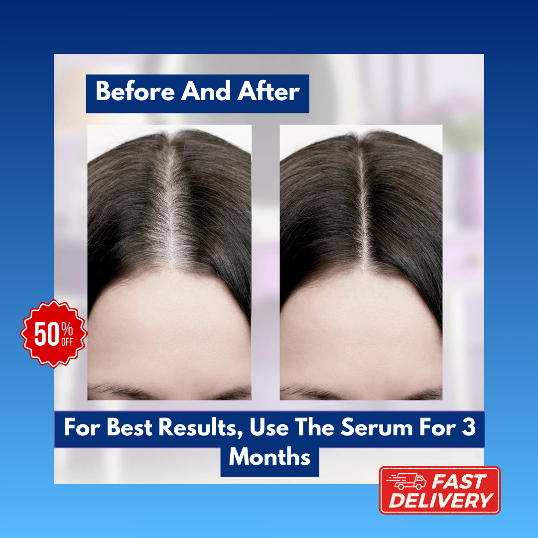 Solara's Hair Growth Transformation Serum