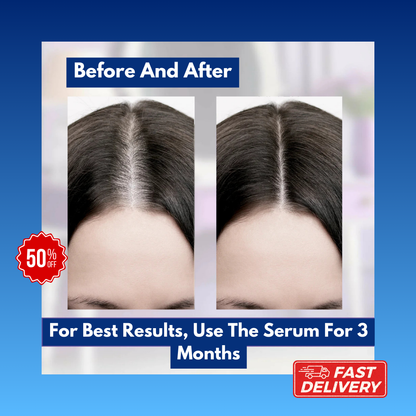 Solara's Hair Growth Transformation Serum